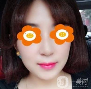 長(zhǎng)沙貝美醫(yī)院做鼻子怎么樣?一覽價(jià)格表費(fèi)用詳情