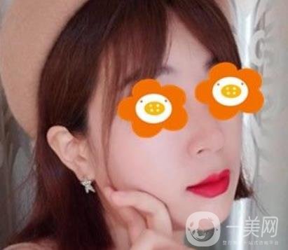長(zhǎng)沙貝美醫(yī)院做鼻子怎么樣?一覽價(jià)格表費(fèi)用詳情