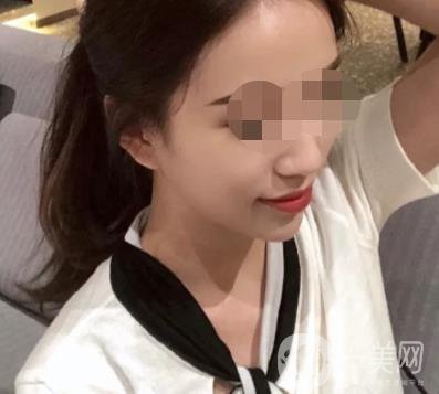 重慶附一院整形科價格表2020年公布，附祛痣整形日記