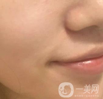 重慶附一院整形科價格表2020年公布，附祛痣整形日記