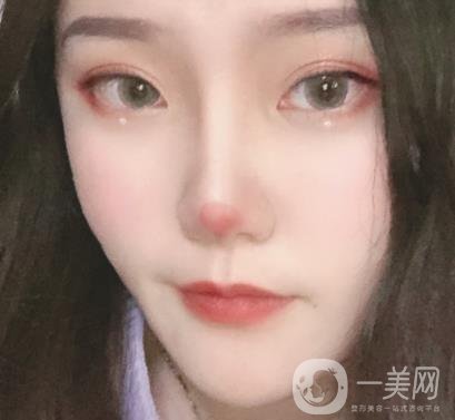 杭州市第三醫(yī)院整形價格表及*案例一覽