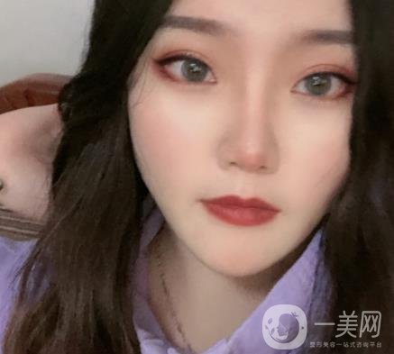 杭州市第三醫(yī)院整形價格表及*案例一覽