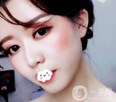 劉波醫(yī)生隆鼻修復