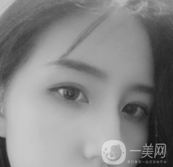 布仁醫(yī)生隆鼻