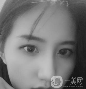 布仁醫(yī)生隆鼻