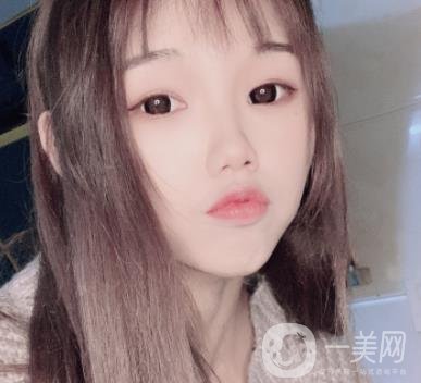 上海時光醫(yī)院何晉龍磨骨怎么樣？價格表及術(shù)后*果分享