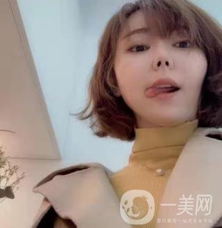 西南醫(yī)院美容整形科打*多少錢？?jī)r(jià)格表及案例*果