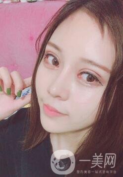 蘭大二院整形外科價(jià)格表2020，附雙眼皮整形日記