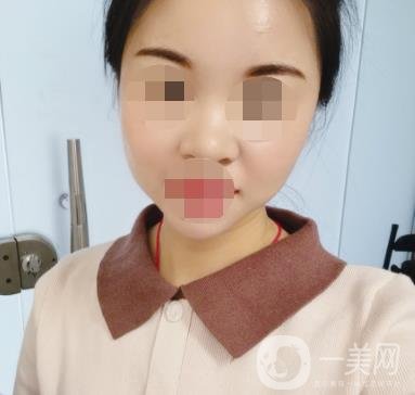 北京醫(yī)院整形科繡眉*果怎么樣?2020年價(jià)格表日常收費(fèi)詳情一覽