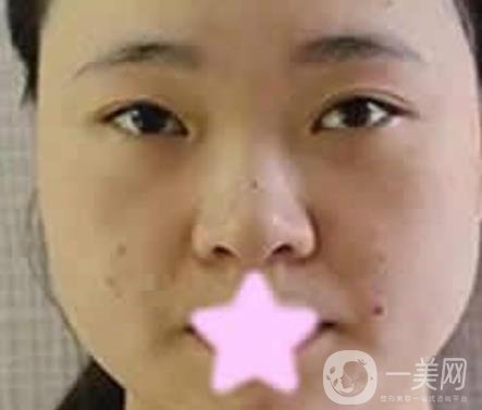 寶雞人民醫(yī)院*