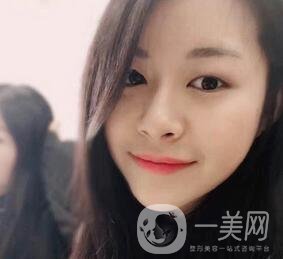 上海華美醫(yī)療美容醫(yī)院價(jià)格表，附雙眼皮修復(fù)案例