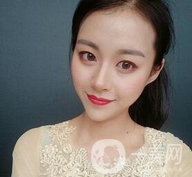 上海華美醫(yī)療美容醫(yī)院價(jià)格表，附雙眼皮修復(fù)案例