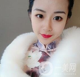 上海華美醫(yī)療美容醫(yī)院價(jià)格表，附雙眼皮修復(fù)案例