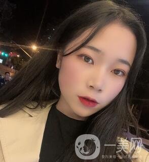 西安高一生醫(yī)療美容醫(yī)院價格表，附面部吸脂案例分享