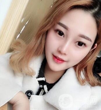 成都銅雀臺(tái)整形醫(yī)院隆鼻案例分享，附全新價(jià)格表