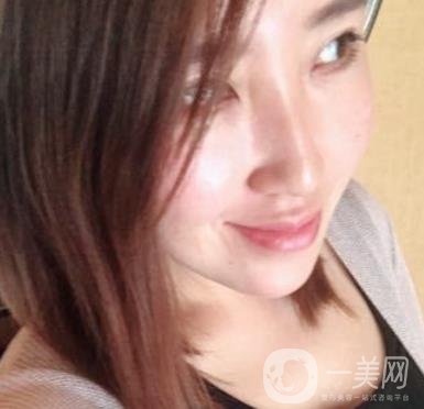 常州美貝爾整形美容醫(yī)院*注射多少錢？價格明細和*果圖展示