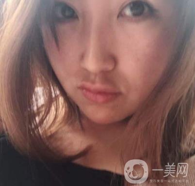 常州美貝爾整形美容醫(yī)院*注射多少錢？價格明細和*果圖展示