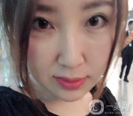 常州美貝爾整形美容醫(yī)院*注射多少錢？價格明細和*果圖展示