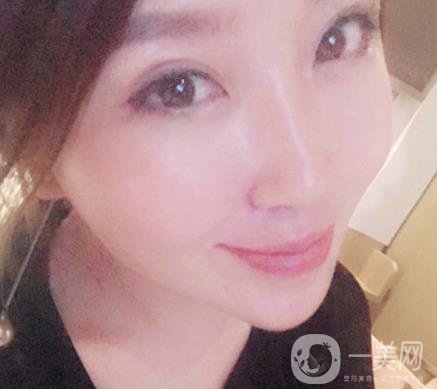 常州美貝爾整形美容醫(yī)院*注射多少錢？價格明細和*果圖展示