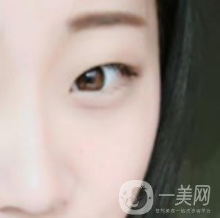 沈陽百嘉麗醫(yī)院價格表2020，附雙眼皮案例分享