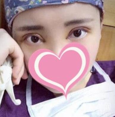 濟(jì)南中心醫(yī)院價格表，雙眼皮整形日記公布