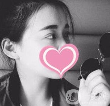 濟(jì)南中心醫(yī)院價格表，雙眼皮整形日記公布