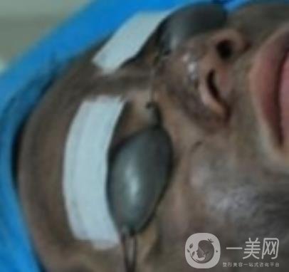 上海星和醫(yī)美整形醫(yī)院*祛斑*果圖和價格價目表2020年