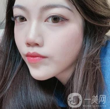 上海星和醫(yī)美整形醫(yī)院*祛斑*果圖和價格價目表2020年