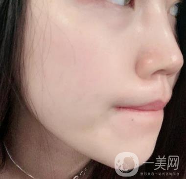 上海星和醫(yī)美整形醫(yī)院*祛斑*果圖和價格價目表2020年