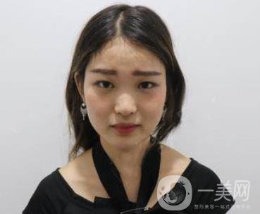 西安華旗唯美整形醫(yī)院做*多少錢？?jī)r(jià)格表收費(fèi)明細(xì)和案例分享