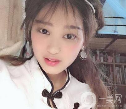 西安華旗唯美整形醫(yī)院做*多少錢？?jī)r(jià)格表收費(fèi)明細(xì)和案例分享