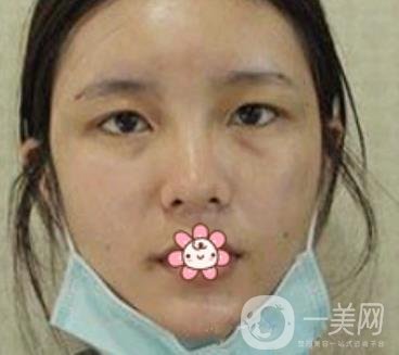 襄陽(yáng)中心醫(yī)院整形美容科價(jià)格表2020版出爐，附雙眼皮日記