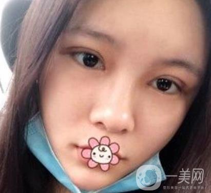 襄陽(yáng)中心醫(yī)院整形美容科價(jià)格表2020版出爐，附雙眼皮日記