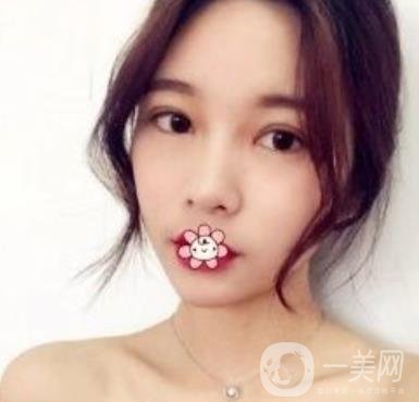 襄陽(yáng)中心醫(yī)院整形美容科價(jià)格表2020版出爐，附雙眼皮日記