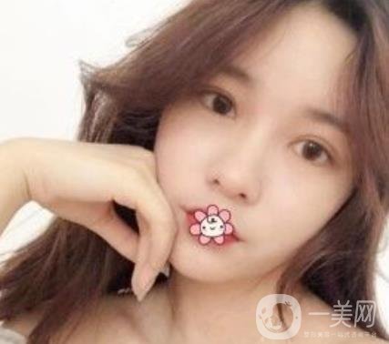 襄陽(yáng)中心醫(yī)院整形美容科價(jià)格表2020版出爐，附雙眼皮日記