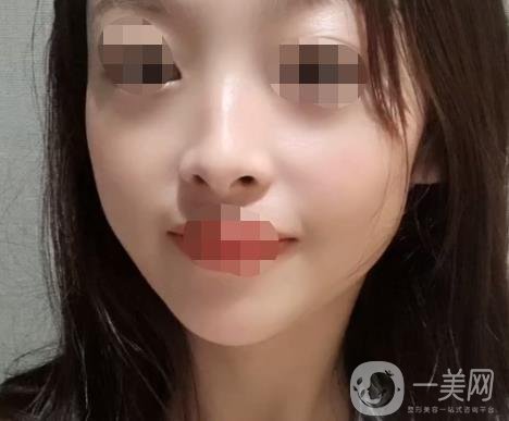 岳陽市一人民醫(yī)院整形美容科價(jià)格表及祛斑案例發(fā)布