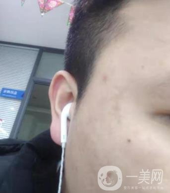 廣州名韓整形醫(yī)院價格表費用詳情+激光祛斑案例分享