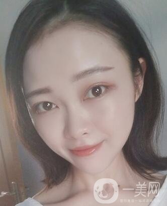 徐州亞韓整形醫(yī)院價(jià)格表費(fèi)用明細(xì)，附面部除皺日記展示