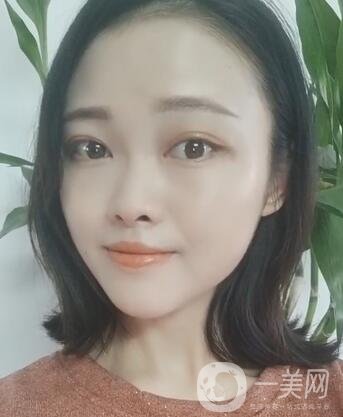 徐州亞韓整形醫(yī)院價(jià)格表費(fèi)用明細(xì)，附面部除皺日記展示