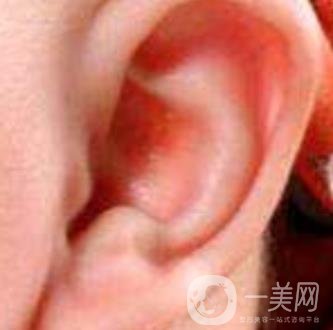 中國醫(yī)學(xué)科學(xué)院整形外科醫(yī)院外耳再造技術(shù)如何?*果好嗎?價(jià)格表收費(fèi)標(biāo)準(zhǔn)一覽