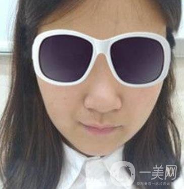 北京亞楠容悅醫(yī)療美容**果靠譜嗎?2020年價(jià)格明細(xì)一覽表