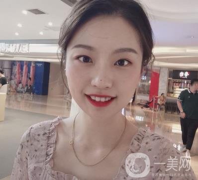 北京知音醫(yī)療美容熱瑪吉*果怎么樣？貴嗎？收費價格表2020公布