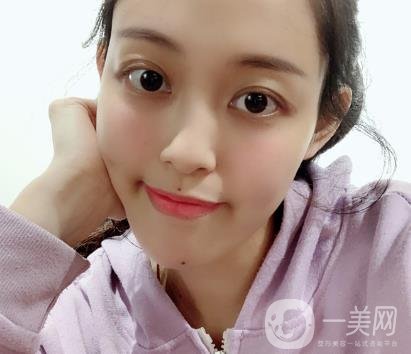 成都美容整形醫(yī)院做脂肪填充全臉*果靠譜嗎?近期價(jià)格表和案例參考