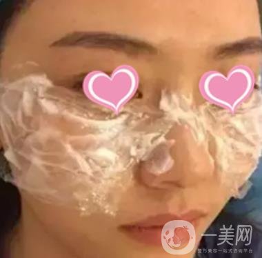 徐州二院激光祛斑怎么樣?案例及2020整形價(jià)格表一覽