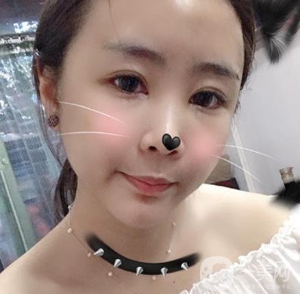 重醫(yī)附一院祛痣多少錢一顆?2020整形價格表及案例*果圖分享