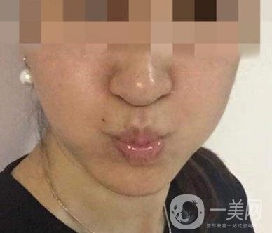 寧波第一醫(yī)院整形美容科價(jià)格表（價(jià)格）新版發(fā)布,及*案例*果