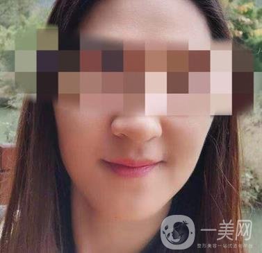 寧波第一醫(yī)院整形美容科價(jià)格表（價(jià)格）新版發(fā)布,及*案例*果