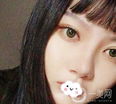 贛南醫(yī)學(xué)院第一附屬醫(yī)院整形美容科價(jià)格表2020+雙眼皮案例一覽