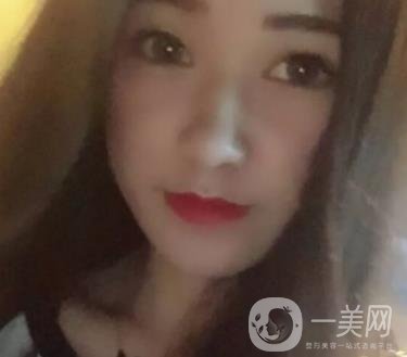 徐州第一人民醫(yī)院整形科價格表，含激光祛疤*果