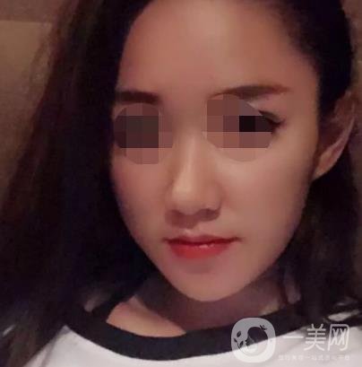 徐州第一人民醫(yī)院整形科價格表，含激光祛疤*果